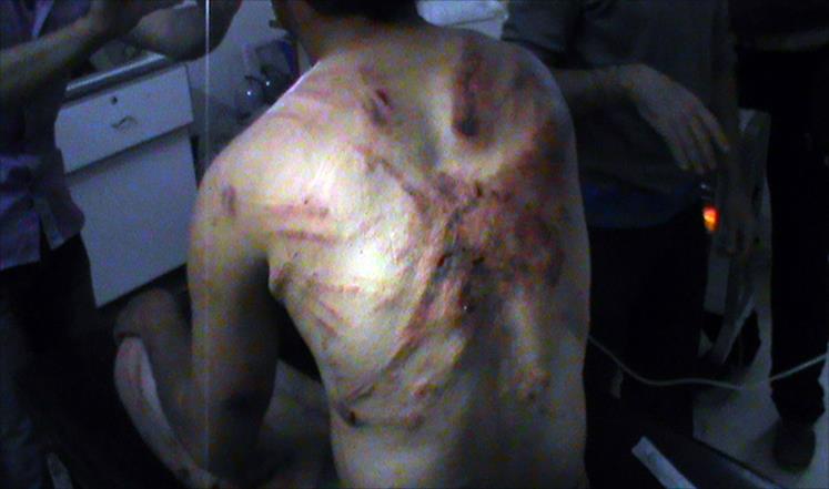 Photo of سوريا.. كم شخصا قتل النظام تحت التعذيب؟