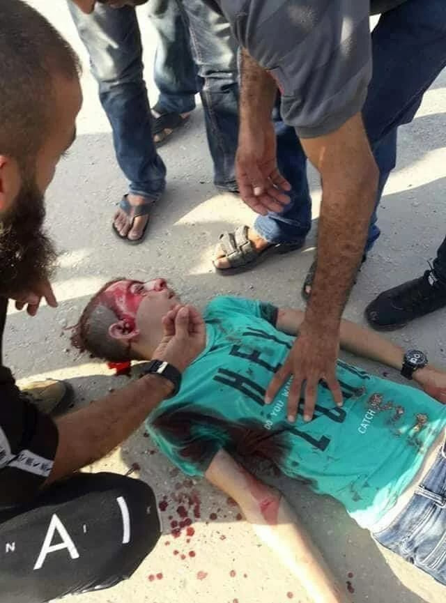 Photo of استشهاد طفلان وإصابات بسلسلة غارات إسرائيلية على القطاع