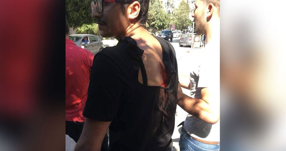 Photo of إصابات في اعتداء أمن جامعة “النجاح” وشبيبة فتح على طلاب “الإسلامية”