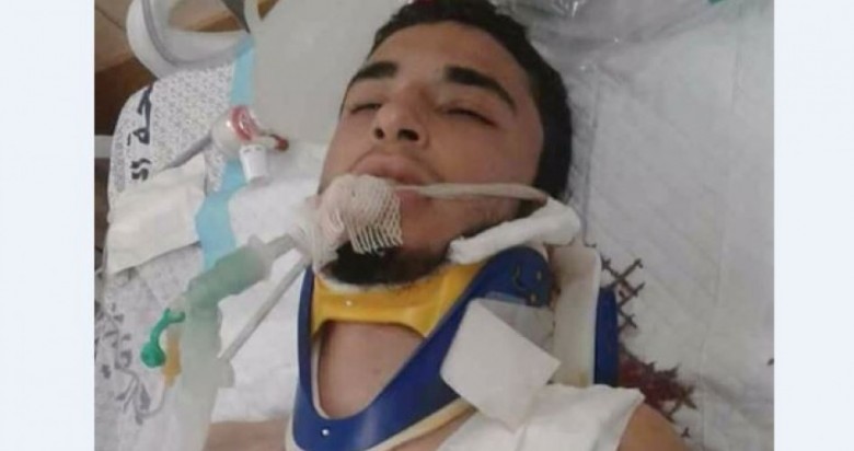 Photo of غزة: شهيد متأثرا بإصابته خلال تظاهرات مسيرة العودة