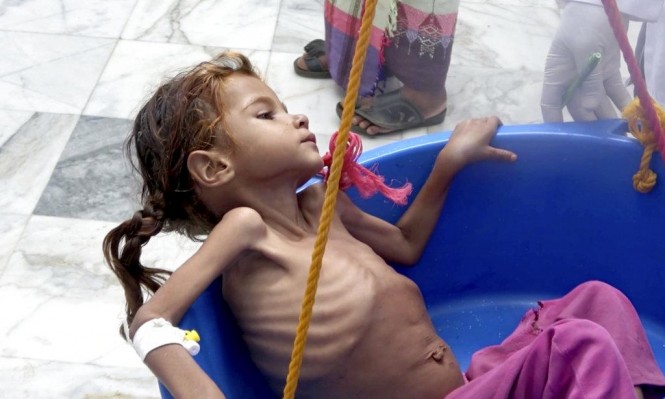 Photo of 8 ملاييين يمني لا يعرفون متى سيتناولون وجبتهم الغذائية التالية