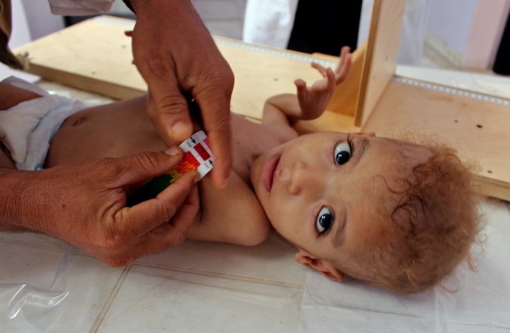 Photo of منظمة تقدم رقما “مفزعا” لوفيات أطفال اليمن جراء الجوع