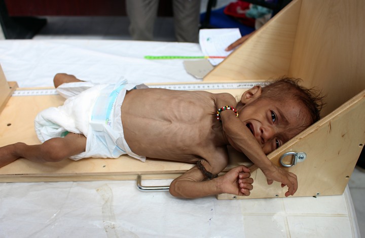Photo of “منظمة الطفولة”: طفل يمني يموت كل 10 دقائق بسبب الحرب