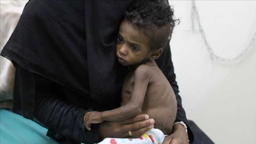 Photo of الأمم المتحدة: 5.1 ملايين يمني يعيشون بمناطق يصعب الوصول إليها