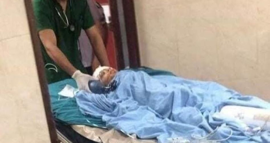 Photo of استخراج 70 شظية من رأسه..تدهور حاد في الوضع الصحي للطفل الجريح شتيوي