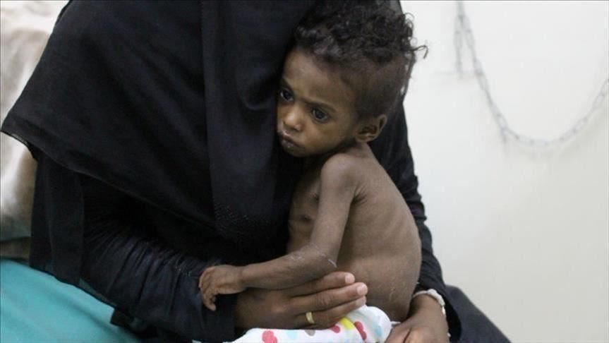 Photo of الأمم المتحدة: 773 وفاة بالكوليرا في اليمن منذ بداية 2019