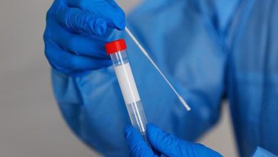 Photo of 3 وفيات و719 إصابة بـ”كورونا” في أراضي الـ 67