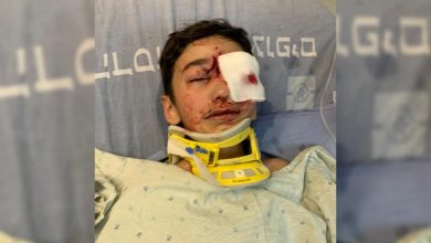 Photo of الاحتلال يغلق التحقيق بفقدان عين طفل مقدسي بزعم عدم توفر أدلة