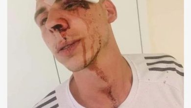 Photo of شاب مقدسي: نحو اربعين مستوطنًا اعتدوا علي وتلقيت معاملة عنصرية في المشفى