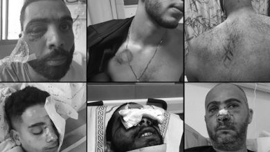 Photo of شهادات على العنصرية الإسرائيلية… الحقد الاسرائيلي خلال الأحداث الأخيرة ظهر بالتنكيل على أجساد الشبان العرب