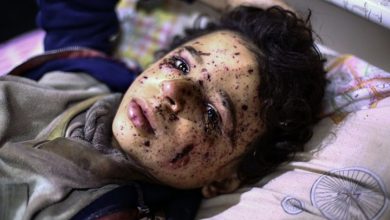 Photo of تقرير حقوقي: أكثر من 29 ألف طفل قتلوا في سوريا