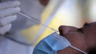 Photo of بعد عامين.. اكتشاف سر فقدان الشم والتذوق لدى مرضى كورونا