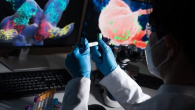 Photo of منظمة الصحة العالمية: وفاة طفل في تفشٍ لمرض غامض يصيب الكبد صحة