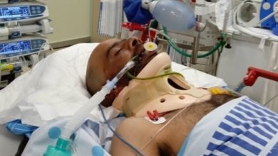 Photo of إصابة شادي عماش من جسر الزرقاء بجراح خطيرة بعد تعرضه للإعتداء خلال عمله