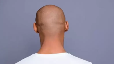 Photo of لا صلع بعد اليوم.. حبة صغيرة ورخيصة من علاج قديم تحدث فرقا