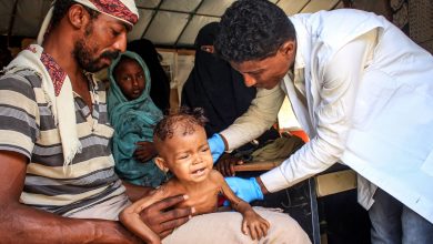 Photo of الموت جوعاً… الأزمة الإنسانية المنسية لأطفال اليمن