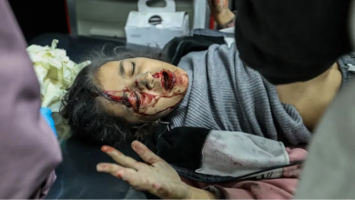 Photo of “أجساد مقطعة”.. شهادات مفزعة لأطباء أمريكيين كانوا في غزة