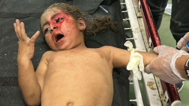 Photo of جروح المصابين الملتهبة تشبه رائحة الزيت الفاسد… منظمة أطباء بلا حدود تنقل رواية طواقمها وسط الحرب