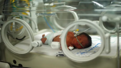 Photo of حياة من رحم الموت.. أطباء ينقذون جنينا بعد استشهاد والدته بغزة