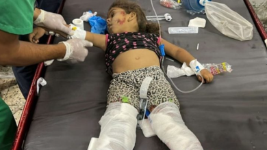 Photo of د. منير البرش: إسرائيل تستخدم أسلحة تسبب حروقا شديدة بأجسام الضحايا في غزة