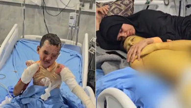 Photo of مدير مستشفى كمال عدوان في غزة: المنظومة الصحية منهارة والجرحى يموتون