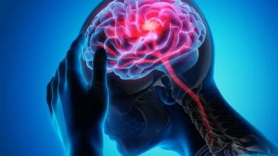 Photo of لماذا تكون آثار السكتة الدماغية أشد لدى البعض؟