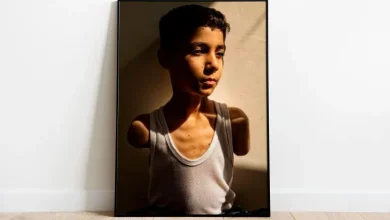 Photo of صورة طفل فلسطيني بترت ذراعاه تفوز بجائزة وورلد برس فوتو