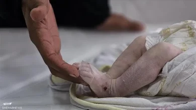 Photo of تشوه الأجنة في غزة: ولادة صادمة لطفلة “بلا دماغ” بسبب الأسلحة الإسرائيلية