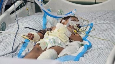 Photo of من بينهم أطفال.. شهداء وجرحى بغارات إسرائيلية على القطاع في اليوم ال 581 من الحرب