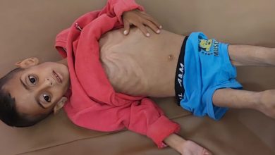 Photo of غزة: وفاة 66 طفلا نتيجة سوء التغذية