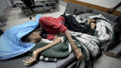 Photo of الشابة رحيل.. ضحية جديدة للاحتلال والتجويع في غزة