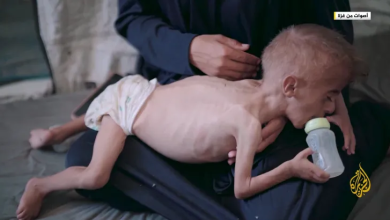 Photo of مرصد عالمي: المجاعة تتكشف في قطاع غزة