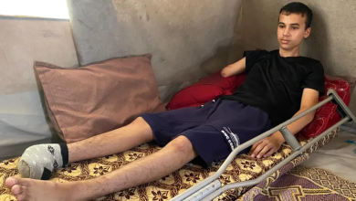 Photo of حرمه احتراف كرة القدم.. صاروخ إسرائيلي يبتر أطراف طفل من غزة (شاهد)