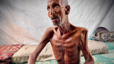 Photo of صورة مسن جائع في غزة تُشعل الغضب وتُجسّد فظاعة المجاعة (شاهد)