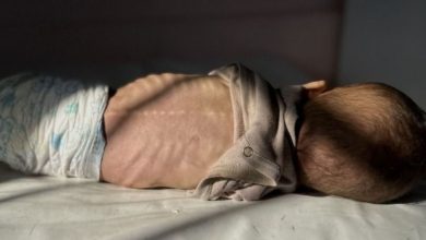 Photo of وزارة الصحة: ارتفاع ضحايا المجاعة في غزة إلى 217 بينهم 100 طفل