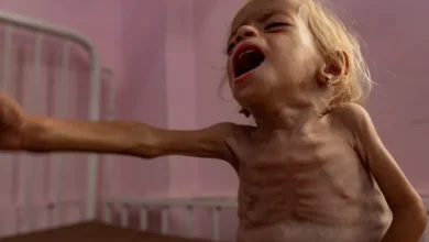 Photo of غوتيريش: مجاعة غزة كارثة من صنع البشر ولا مناص من العقاب