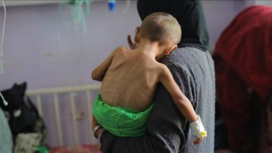 Photo of صحة غزة: ارتفاع وفيات التجويع الإسرائيلي إلى 453 بينهم 150 طفلا