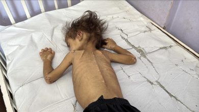 Photo of ارتفاع ضحايا التجويع الإسرائيلي في غزة إلى 404 فلسطينيين
