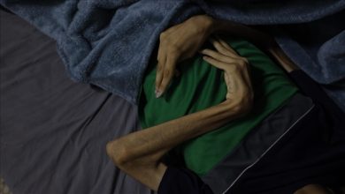 Photo of غزة.. ارتفاع حصيلة وفيات التجويع الإسرائيلي إلى 376 فلسطينيا
