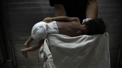 Photo of صحة غزة: ارتفاع وفيات التجويع الإسرائيلي إلى 457 بينهم 152 طفلا