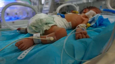 Photo of الأمم المتحدة: سوء تغذية الحوامل والرضّع في غزة سيخلّف آثارًا تمتد لأجيال