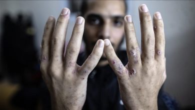 Photo of إعلام الأسرى: تفاقم انتشار الجرب والقمع ضد فلسطينيين بسجن إسرائيلي