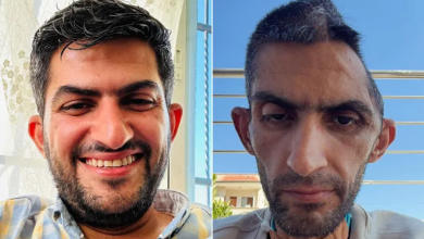 Photo of جمجمته تروي العذاب.. صورة صادمة لمجاهد بني مفلح بعد خروجه من سجون الاحتلال (شاهد)