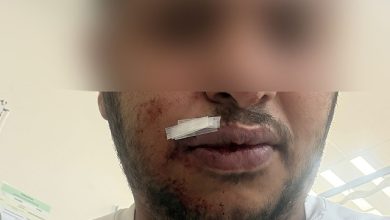 Photo of إصابة عامل عربي من تل السبع في اعتداء عنصري ببئر السبع
