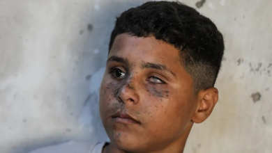 Photo of عادل العشي.. خرج ليلعب كرة القدم فعاد فاقدا عينه وسمعه في غزة (شاهد)
