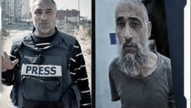 Photo of محمد عرب.. صحفي غيّرت سنوات الأسر ملامحه وبقيت آثار جريمة الاحتلال حاضرة (شاهد)