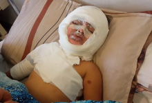 Photo of عائلتها تتطلع لعلاجها بالخارج.. غارة إسرائيلية تحرق “مسك” وتفقدها السمع والنطق (شاهد)