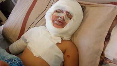 Photo of عائلتها تتطلع لعلاجها بالخارج.. غارة إسرائيلية تحرق “مسك” وتفقدها السمع والنطق (شاهد)