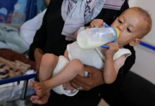 Photo of سوء التغذية يفاقم معاناة أطفال غزة