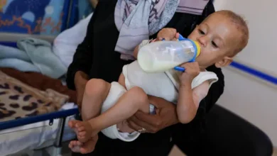 Photo of سوء التغذية يفاقم معاناة أطفال غزة